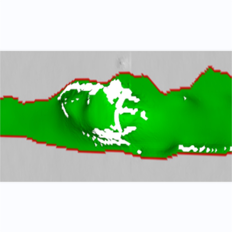 激光焊接常見的十四種焊縫缺陷